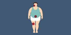 Η απώλεια βάρους μειώνει τον πόνο που σχετίζεται με την παχυσαρκία - απώλεια βάρους